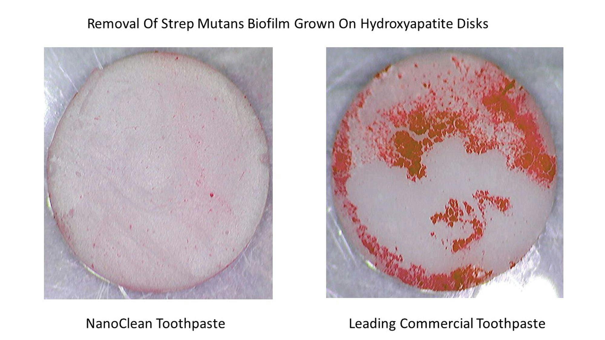 A Novel Toothpaste With Superior Plaque and Biofilm Removal