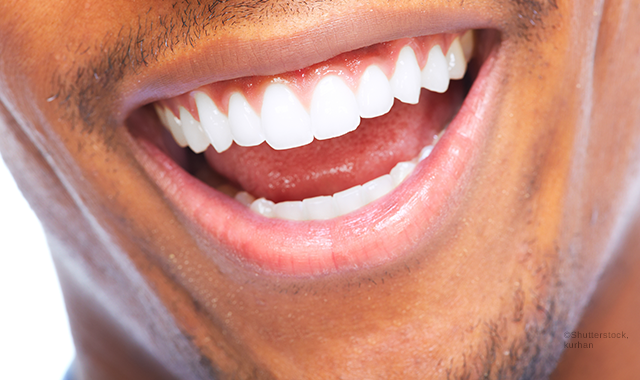 4 easy ways to get into cosmetic dentistry